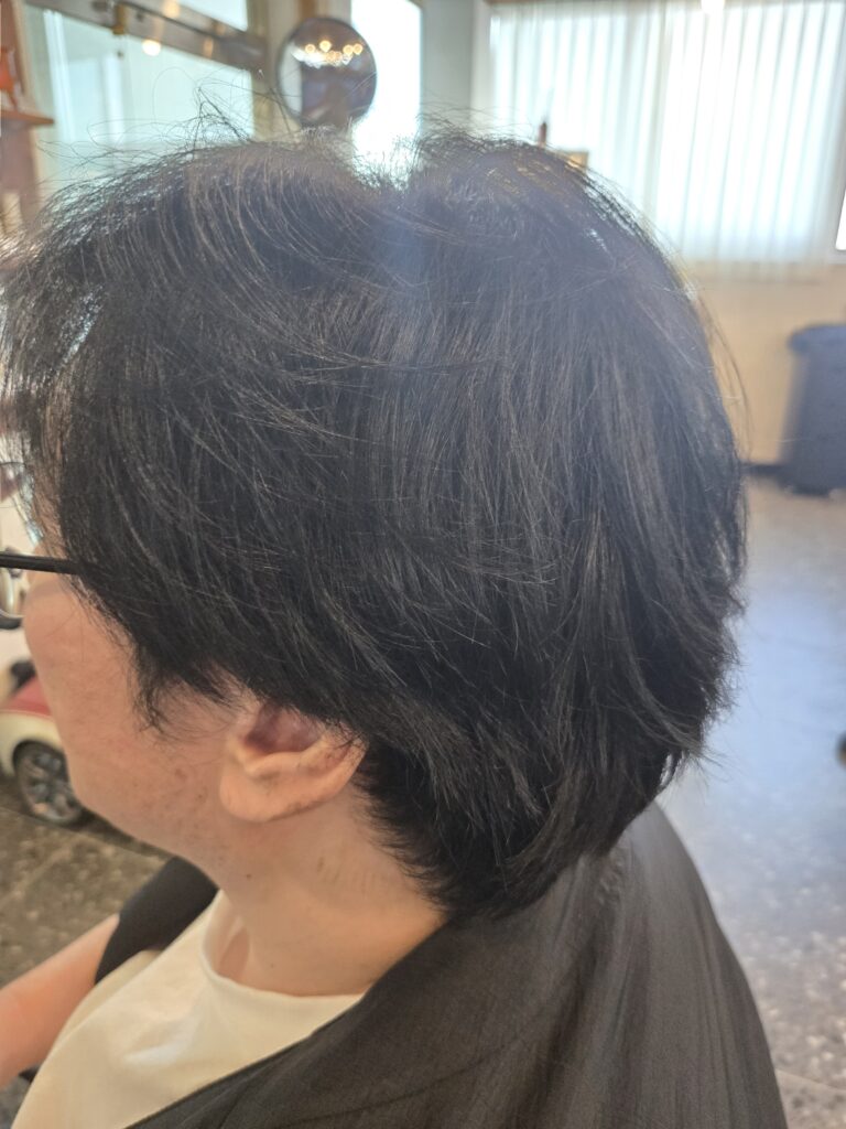 윤진스헤어 시술 전 옆모습 헤어 상태